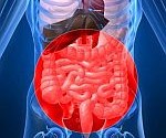 bacterial gastroenteritis